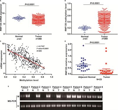 RNF135 Promoter Methylation Is Associated With Immune Infiltration and Prognosis in Hepatocellular Carcinoma